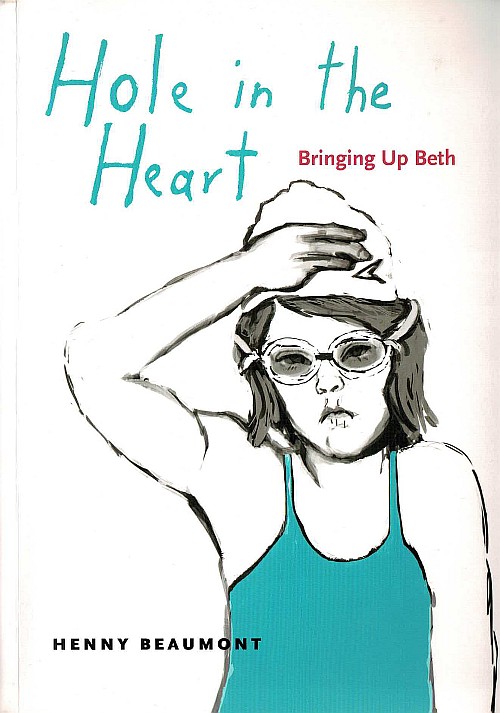 『Hole in the Heart： Bringing Up Beth』 『心の穴――ダウン症のある娘ベスを育てること』未訳